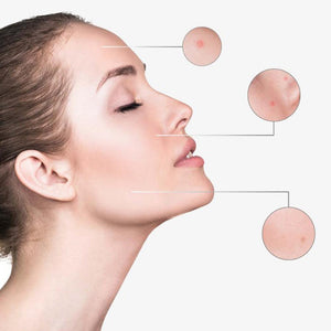 Retinol Serum with Hyaluronic Acid & Vitamin E