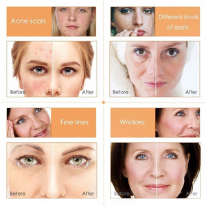 Vitamin C Serum